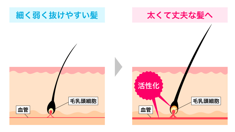ミノキシジルの育毛効果の説明図